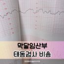 태동 | 36주이상 임산부 태동검사 후기 및 태동검사 비용 공유해요!