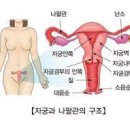 자궁내막 용종 생리가 아닌데요 피가 나온다면 이미지