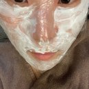 차외과의원 | 여신티켓 리쥬란힐러_3회 차 미톡스외과의원 시술 솔직 후기