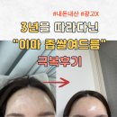 수부지 이마 좁쌀여드름 극복후기 ㅣ지성 건성 피부테스트 ㅣ내돈내산 광고 X