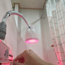 중골 | [병상일지] 중골 미세골절 14일차 (feat.경골 미세골절)