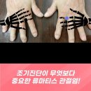 여주-1099 | 류마티스 내과 검사, 자가면역질환 판별의 첫걸음! [류마티스 내과 검사]