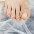 레푸스인천부평씨지브이(CGV)점 | 부평 발관리, 발톱무좀 케어 후기 레푸스부평CGV점