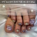 구로-구로-구로-2707 | 보라공주 &#39; 네일샵에서 맨즈네일 과 문제성 발톱관리 후기 (전후사진포함) : 문제성 발톱 증상 / 내성...