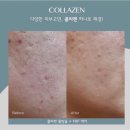 피부맑음 에스테틱 이미지