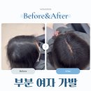 가꾸는여자 | 여자 부분 가발 후기, 필요한 곳만 자연스럽게 커버