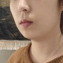 신사역 에이브라인에서 인모드FX 후기