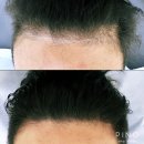 디테일PINO | 미사 SMP 하남 SMP 자연스러움이 살아있는 두피케어, 피노 미사점