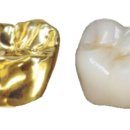 골드크라운 이미지