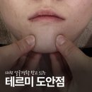 바디 타임즈 | 대전 얼굴경락 테르미 도안점 5회차