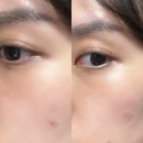 주식회사 나노바이오시스템 | 트러블 진정·상처 케어 기능까지 첨가한 차세대 트러블패치 : 셀로잇 나노패치 솔직후기