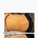 피다다이어트(피다)