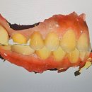 이스타치과기공소 이미지