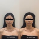 세븐일레븐 청주봉명타운점 | 청주웨딩관리 정담에스테틱 맞춤윤곽관리 | 청주신부관리로 얼굴라인 정리한 후기