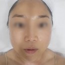 라온메디케어 | 루아 에스테틱 옥정점 스킨 모공 탄력 리프팅 후기