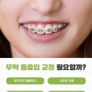 창원교정치과 무턱 돌출입 치아교정