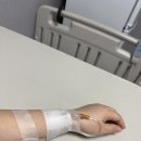 진주제일병원 담낭제거수술 당일 후기 #2