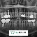 웰스치과의원개포 이미지