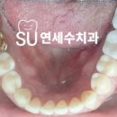 이편한치과기공소 네이버블로그