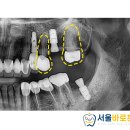 김의치과 이미지