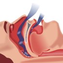 코알수면센터 이미지