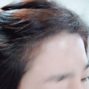 여성탈모 보타랩헤어케어세트로 해결해요