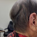 다음보청기 이미지