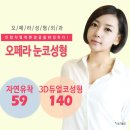 비절개 콧볼축소~ 정말 효과좋은 후기!! 이미지