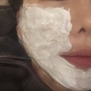 [명동역피부과]친절한 상담과 꼼꼼한 시술로 온다리프팅 받고 왔어요