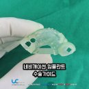 이세치과의원 | 네비게이션임플란트 가격 이슈?