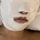광주 광산구 첨단 ‘맑은린에스테틱’ 피부관리실, 데콜테관리 &amp; 물방울초음파관리 후기