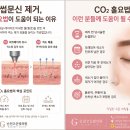 고운빛의원 티스토리