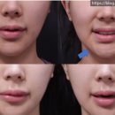 리터닝성형외과의원 이미지