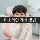 미소라인