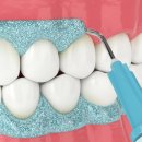 이-조은치과의원 이미지