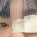 데미안안과의원 네이버블로그