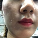 밝은달한의원 이미지