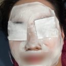 신기119안전센터 (옥내1) | 광명 윤곽관리 고담코스메틱 리셋핏윤곽관리 솔직후기｜얼굴 비대칭 전후 비교