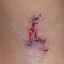 청담지움성형외과의원 이미지