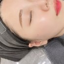 미더베스트마곡점 | 마곡피부관리 미더베스트마곡점에서 리프팅 후기