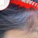 그로우메디 이미지