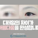 미헤어라인 이미지