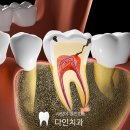 조치원치과기공소 이미지