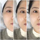 바르다축산 | 서면에스테틱 피부피티센터 재방문 후기🥽ㅣ세멘시트 케어 • 전포피부관리 추천