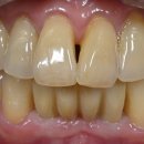 엠웍스 치과기공소 이미지