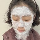 벼리약국 | 편평사마귀 제거 후기(내돈내산 CO2 레이저) +꼭 하세요