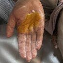 중동뷰티호텔 | 부천중동에스테틱 뷰티호텔180 모공디톡스 재생케어 후기