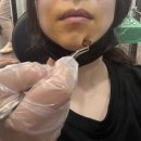 청심홈인테리어 | 진주 치과의원 청심플란트 크라운 임플란트 시술 후기