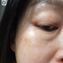 오브베이스 마스크팩추천 셀피쉬 블루밍 마스크팩 미백 필링 보습 케어 후기