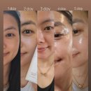 인셀덤햇살 | ICD 래디언솜 100 마이크로플루다이저 크림, 화해 브라이트닝 부문 1위 수상 ✨️